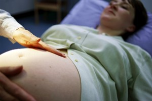 Наблюдение за беременными